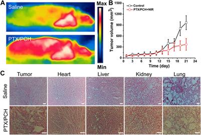 Redox-responsive hyaluronan-conjugated polypyrrole nanoparticles targeting chemo-photothermal therapy for breast cancer